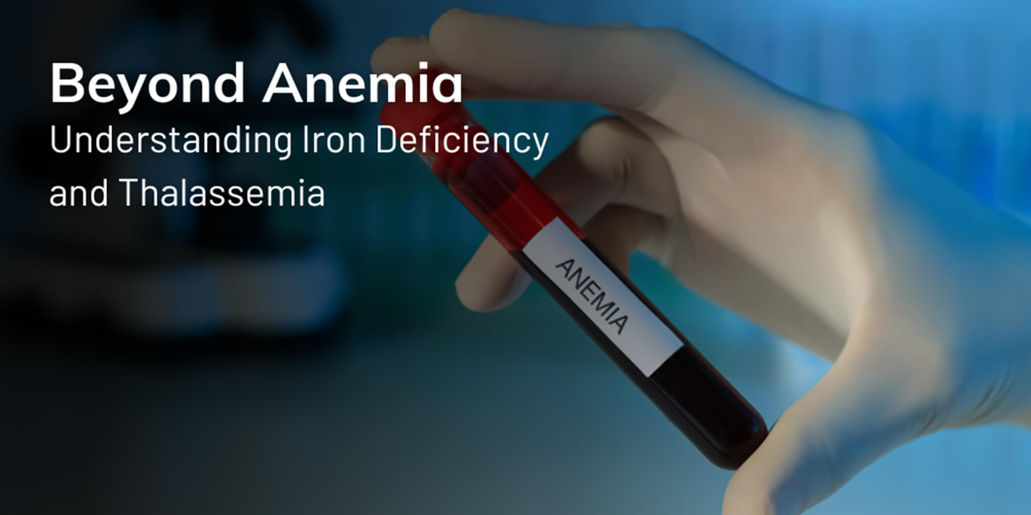 iron deficiency vs thalassemia​