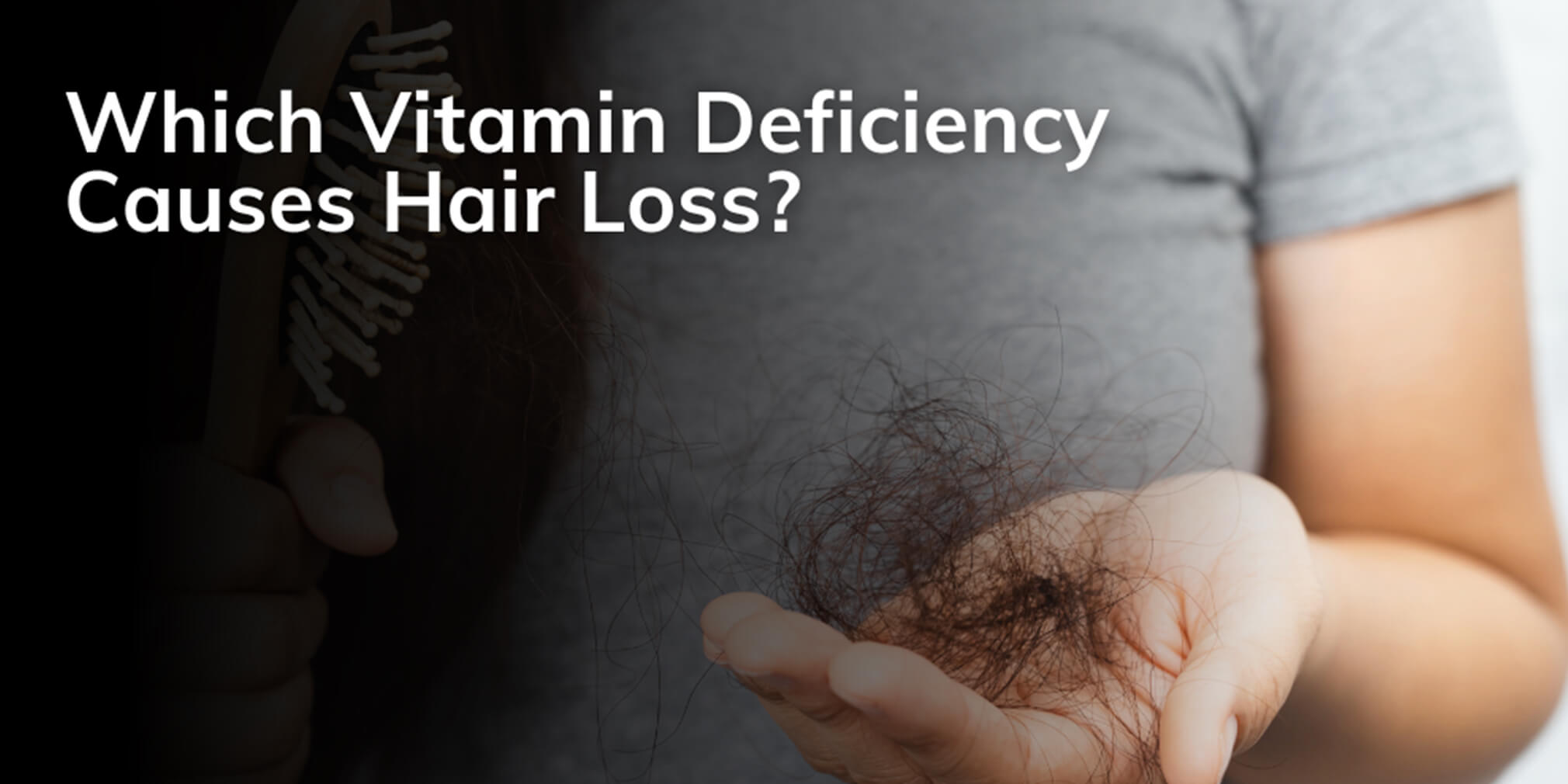 which vitamin deficiency causes hair loss